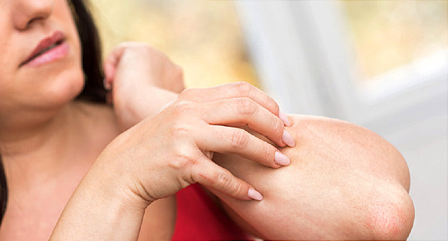 sweating affects your skin