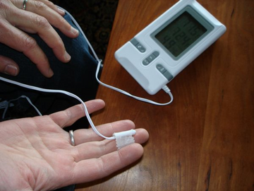 Biofeedback as an alternative hyperhidrosis treatment.