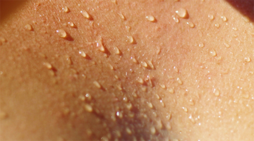 Sweat on skin. 
